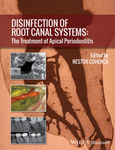 Shaping the root canal system to promote effective disinfection by Ove A. Peters and Frank Paque